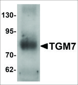 Anti-TGM7 antibody produced in rabbit affinity isolated antibody