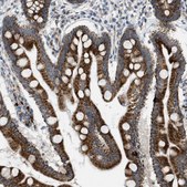 Anti-TPH1 antibody produced in rabbit Prestige Antibodies&#174; Powered by Atlas Antibodies, affinity isolated antibody, buffered aqueous glycerol solution