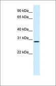 Anti-HGF (ab1) antibody produced in rabbit affinity isolated antibody