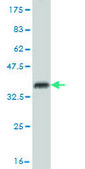 Monoclonal Anti-USP14 antibody produced in mouse clone 6D6, purified immunoglobulin, buffered aqueous solution