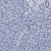 Anti-ADH4 antibody produced in rabbit Prestige Antibodies&#174; Powered by Atlas Antibodies, affinity isolated antibody, buffered aqueous glycerol solution