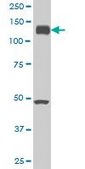 Monoclonal Anti-EPHA2 antibody produced in mouse clone 1E3, purified immunoglobulin, buffered aqueous solution
