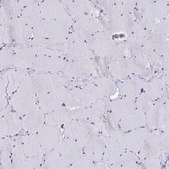 Anti-ACTL6B antibody produced in rabbit Prestige Antibodies&#174; Powered by Atlas Antibodies, affinity isolated antibody, buffered aqueous glycerol solution