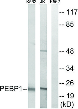 Anti-PEBP1 antibody produced in rabbit affinity isolated antibody