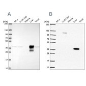 Anti-ADH6 Prestige Antibodies&#174; Powered by Atlas Antibodies, affinity isolated antibody