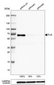 Monoclonal Anti-FUS antibody produced in mouse Prestige Antibodies&#174; Powered by Atlas Antibodies, clone CL0190, purified immunoglobulin, buffered aqueous glycerol solution