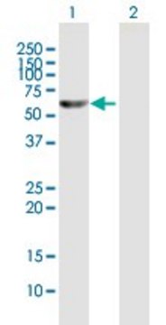 Anti-TXNRD1 antibody produced in mouse IgG fraction of antiserum, buffered aqueous solution