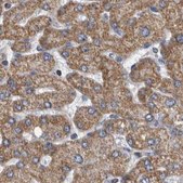 Anti-MDH2 antibody produced in rabbit Prestige Antibodies&#174; Powered by Atlas Antibodies, affinity isolated antibody, buffered aqueous glycerol solution
