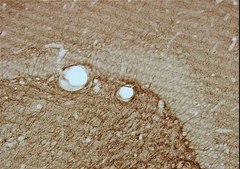 Anti-CNPase Antibody, clone 11-5B clone 11-5B, Chemicon&#174;, from mouse