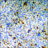 Anti-phospho-CDK1/CDC2 (pThr14) antibody produced in rabbit affinity isolated antibody