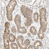 Anti-CDH6 antibody produced in rabbit Ab1, Prestige Antibodies&#174; Powered by Atlas Antibodies, affinity isolated antibody, buffered aqueous glycerol solution