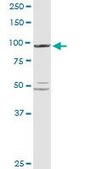 Anti-PYGL antibody produced in rabbit purified immunoglobulin, buffered aqueous solution