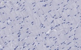 Anti-MYH1 Antibody, clone 1E15 , ZooMAb&#174; Rabbit Monoclonal recombinant, expressed in HEK 293 cells