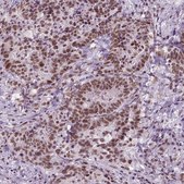 Monoclonal Anti-BRD4 antibody produced in mouse Prestige Antibodies&#174; Powered by Atlas Antibodies, clone CL1115, purified immunoglobulin, buffered aqueous glycerol solution
