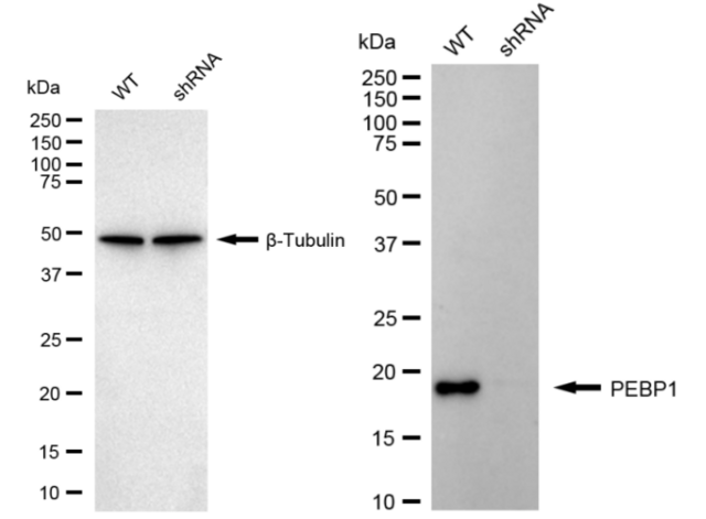 KD-Validated Anti PBP Antibody, clone 24GB860, Rabbit Monoclonal clone 24GB860, recombinant rabbit monoclonal, expressed in HEK293 cells