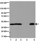 Anti-CNPase Antibody, clone 11-5B clone 11-5B, Chemicon&#174;, from mouse