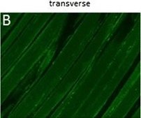 Anti-Collagen Type VI Antibody, clone VI-26 clone VI-26, Chemicon&#174;, from mouse