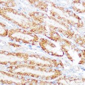 Anti- KEAP1 antibody produced in rabbit