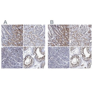 Anti-CALCOCO2 antibody produced in rabbit Prestige Antibodies&#174; Powered by Atlas Antibodies, affinity isolated antibody, buffered aqueous glycerol solution, Ab2