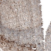 Anti-MB21D1 antibody produced in rabbit Prestige Antibodies&#174; Powered by Atlas Antibodies, affinity isolated antibody, buffered aqueous glycerol solution