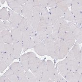 Anti-CFH antibody produced in rabbit Prestige Antibodies&#174; Powered by Atlas Antibodies, affinity isolated antibody, buffered aqueous glycerol solution