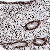 Anti-DNMT3A antibody produced in rabbit Prestige Antibodies&#174; Powered by Atlas Antibodies, affinity isolated antibody, buffered aqueous glycerol solution