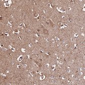 Anti-PGP antibody produced in rabbit Prestige Antibodies&#174; Powered by Atlas Antibodies, affinity isolated antibody, buffered aqueous glycerol solution