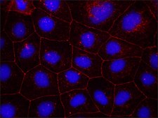 Anti-Occludin antibody from rabbit affinity isolated antibody