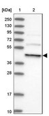 Anti-DCTN4 antibody produced in rabbit Prestige Antibodies&#174; Powered by Atlas Antibodies, affinity isolated antibody, buffered aqueous glycerol solution