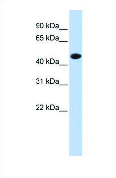 Anti-CKM (ab1) antibody produced in rabbit affinity isolated antibody