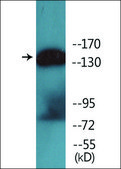 Anti-phospho-HER2 (pTyr1221/Tyr1222) antibody produced in rabbit affinity isolated antibody