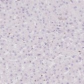Anti-STK39 antibody produced in rabbit Prestige Antibodies&#174; Powered by Atlas Antibodies, affinity isolated antibody, buffered aqueous glycerol solution