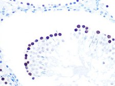 Anti-KAT1/HAT1 antibody produced in rabbit