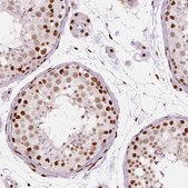 Monoclonal Anti-BRD4 antibody produced in mouse Prestige Antibodies&#174; Powered by Atlas Antibodies, clone CL1118, purified immunoglobulin, buffered aqueous glycerol solution