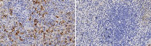 Anti-RANTES Antibody, clone 1K17 ZooMAb&#174; Rabbit Monoclonal recombinant, expressed in HEK 293 cells