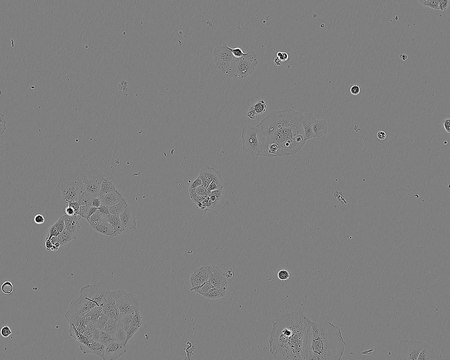 CACO-2 Cell Line human NOTE: Both the cell line and DNA from the cell line may be available for this product. Please choose -1VL or VIAL for cells, or -DNA-5UG for DNA, 86010202, human colon (Caucasian colon adenocarcinoma), Epithelial