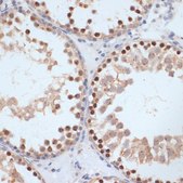 Anti-Phospho-BRCA1-S1423 antibody produced in rabbit