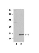 Anti-dimethyl-Histone H3 (Lys27) Antibody Upstate&#174;, from rabbit