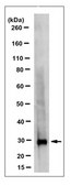 Anti-SDHB Antibody, clone 10C5.1 clone 10C5.1, from mouse