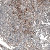 Anti-CSF1R antibody produced in rabbit Prestige Antibodies&#174; Powered by Atlas Antibodies, affinity isolated antibody, buffered aqueous glycerol solution