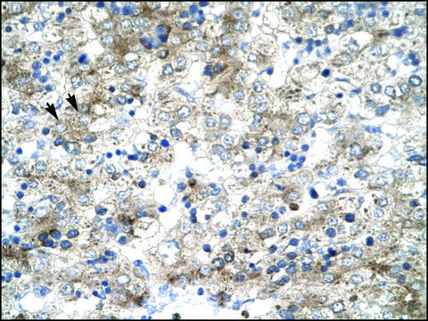 Anti-GTF2H1 antibody produced in rabbit IgG fraction of antiserum