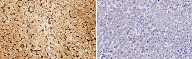 Anti-CD209 Antibody, clone 4B5 ZooMAb&#174; Rabbit Monoclonal recombinant, expressed in HEK 293 cells