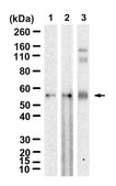 Anti-CRFR1/CRHR1 Antibody, clone 1N21 ZooMAb&#174; Rabbit Monoclonal recombinant, expressed in HEK 293 cells