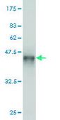 Monoclonal Anti-PHKG1 antibody produced in mouse clone 2B4, purified immunoglobulin, buffered aqueous solution