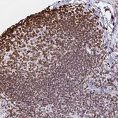 Anti-LMNB1 antibody produced in rabbit Prestige Antibodies® Powered by Atlas Antibodies, affinity isolated antibody, buffered aqueous glycerol solution