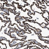 Anti-SLC22A15 antibody produced in rabbit Prestige Antibodies&#174; Powered by Atlas Antibodies, affinity isolated antibody, buffered aqueous glycerol solution