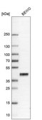 Anti-PRSS8 antibody produced in rabbit Prestige Antibodies&#174; Powered by Atlas Antibodies, affinity isolated antibody, buffered aqueous glycerol solution
