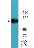 Anti-phospho-HDAC5 (pSer259) antibody produced in rabbit affinity isolated antibody