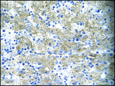 Anti-TAL1 antibody produced in rabbit affinity isolated antibody