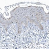 Anti-MYOT antibody produced in rabbit Prestige Antibodies&#174; Powered by Atlas Antibodies, affinity isolated antibody, buffered aqueous glycerol solution